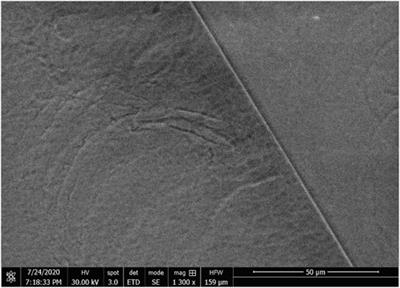 Characterization of dissipative regions of a N-doped superconducting radio-frequency cavity